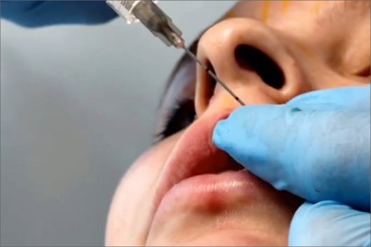 Justiça derruba norma que permite a dentista fazer harmonização facial